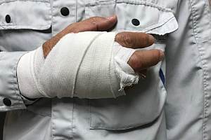 Employee with injured hand in cast